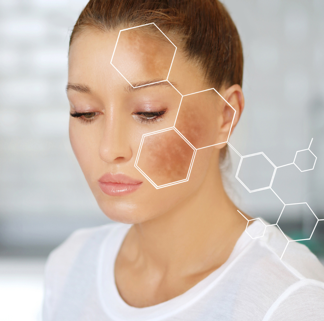 Natural face mask ingredients for dark spots - castor oil, oats and lemon